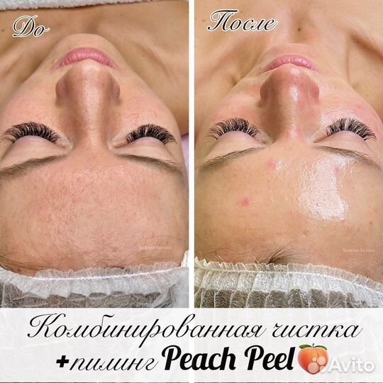 Услуги косметолога