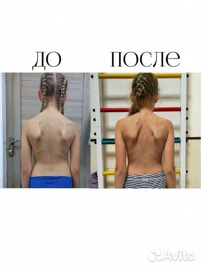 Коррекционная гимнастика