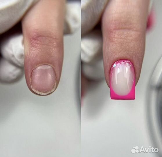 Наращивание ногтей