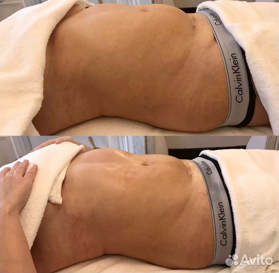 Массаж, ищем модель