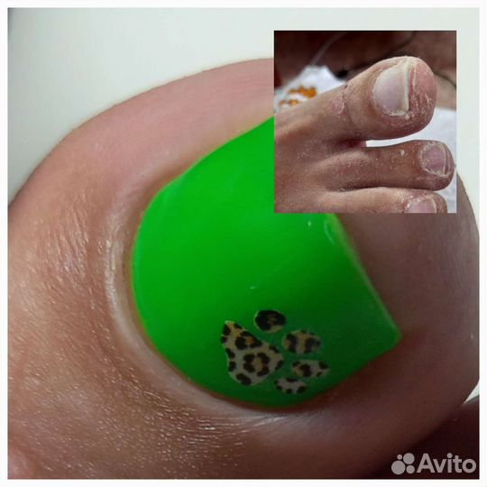 Педикюр, smart педикюр