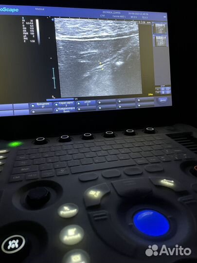 Узи на дому