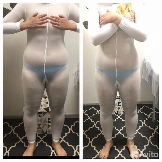 Lpg массаж,прессомассаж, антицеллюлитные комплексы