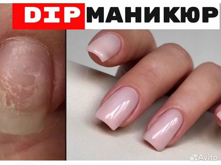 Дип система для ногтей фото покрытие ногтей гелем - Услуги и сервисы в районе Центральный Поиск специалистов