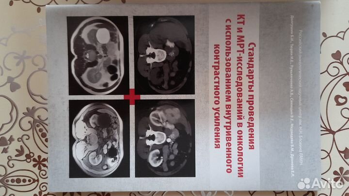 Компьютерная томография в медицине