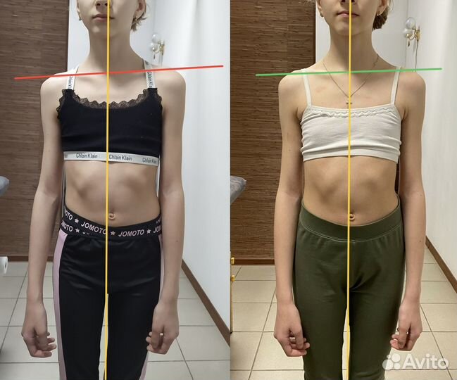 Реабилитация, Массаж, лфк