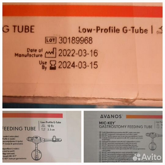 Гастростома