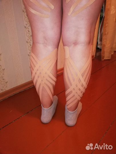 Эстетическое тейпирование лица и тела