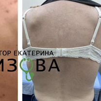 Врач онлайн диетолог, дерматолог, терапевт, пп, Аксу
