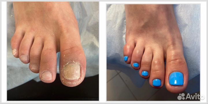 Маникюр педикюр с выездом на дом