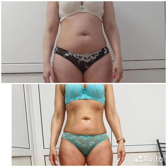 Требуются модели по коррекции фигуры и похудению