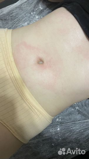 Шугаринг на дому