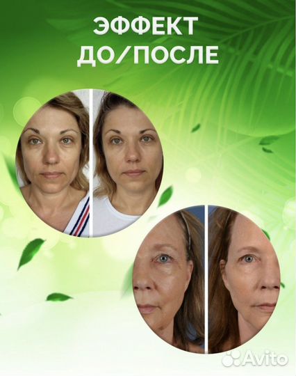 Мезороллер для лица