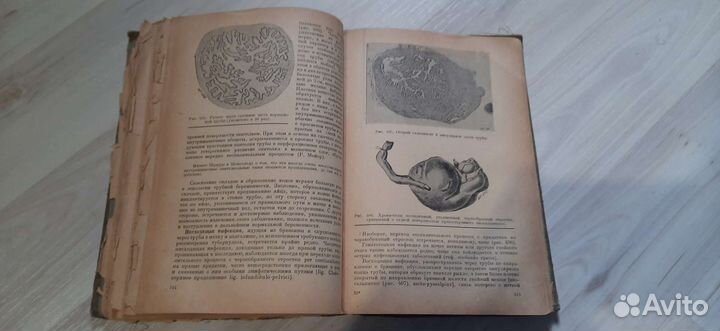 Книга по гинекологии 1932 год