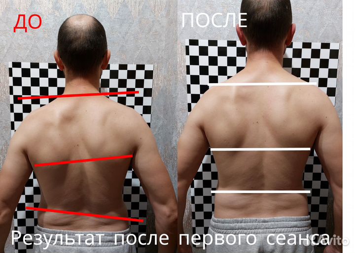 Мануальщик вправление позвонков без боли Ю