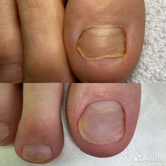 Педикюр подологический (мужской, женский)