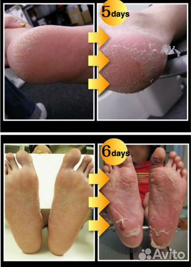 Педикюрные носочки