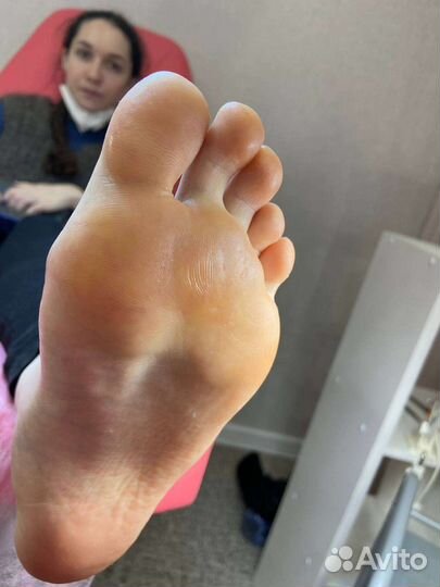 Смарт педикюр