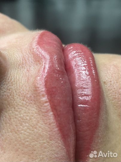 Татуаж, лазерное удаление татуажа и тату