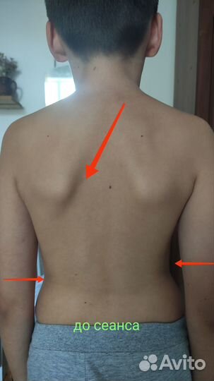 Лечение сколиоза и сопутствующих болезней