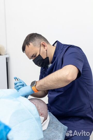 Пересадка волос