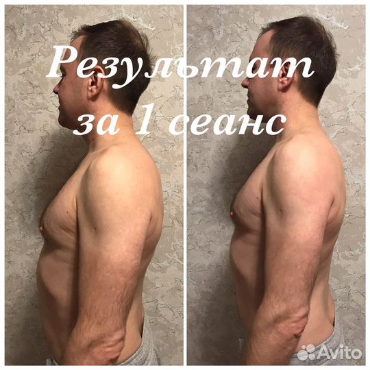 Костоправ, висцеральный массаж живота