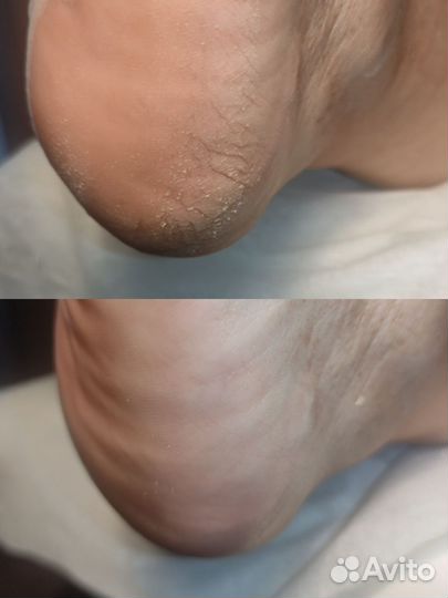 Маникюр, педикюр Smart