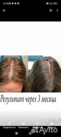 Густой волос