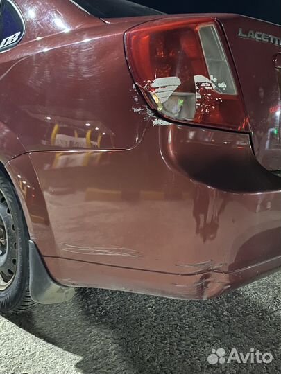 Chevrolet Lacetti 1.6 МТ, 2008, 259 000 км