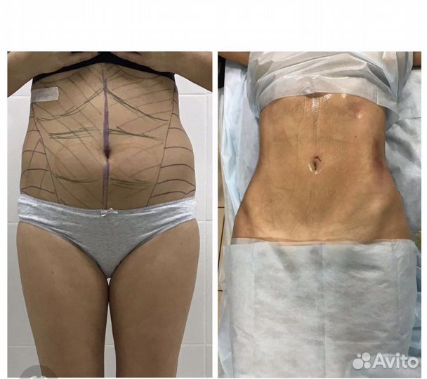 Пластическая хирургия