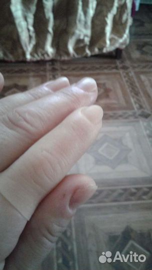 Протез пальца для двух фаланг
