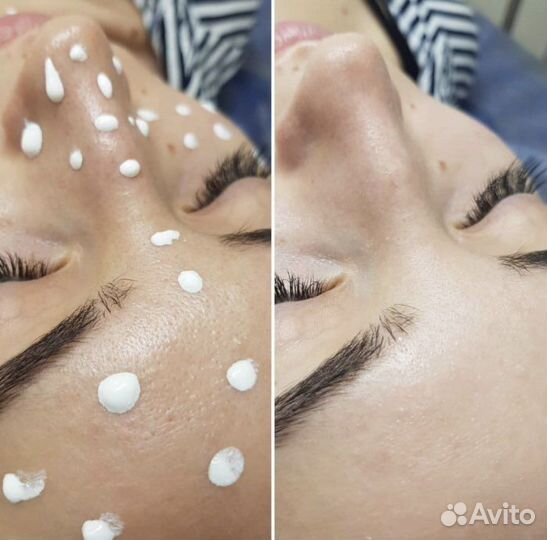 Три вида пилинга (на выбор) + «Фарфоровая куколка»