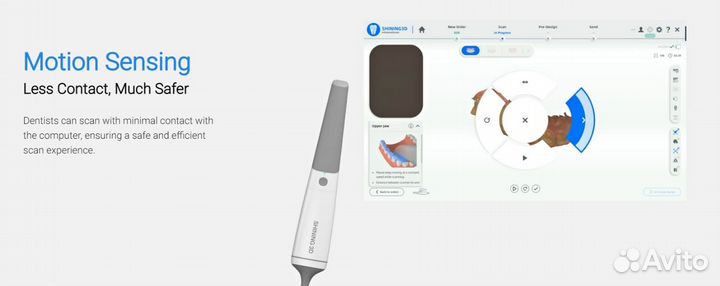 Сканер интраоральный Shining3d Aoralscan 3