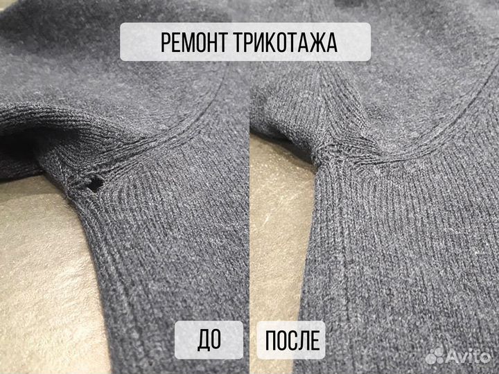 Ремонт трикотажа