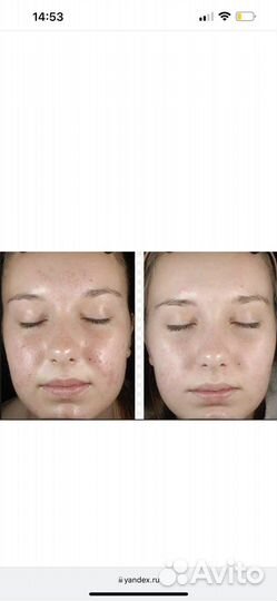 Пилинг mediderma ретиноловый