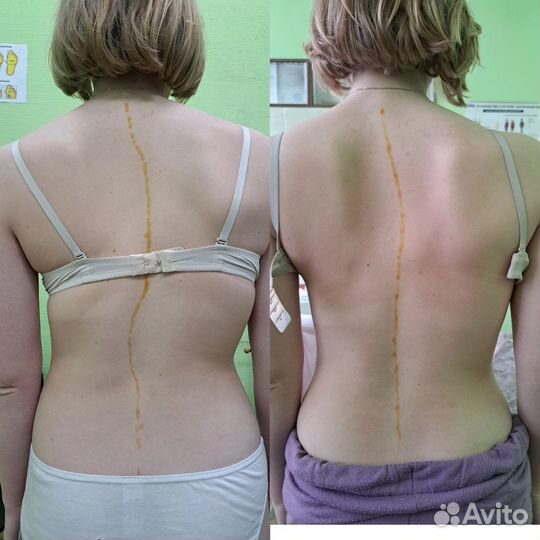 Массаж на дому