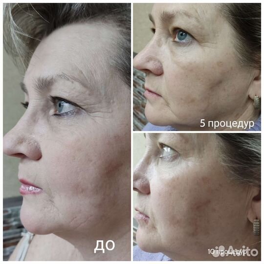 Массаж лица, массаж тела, антицеллюлитный массаж