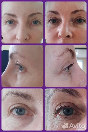 Ламинирование ресниц, окрашивание ресниц