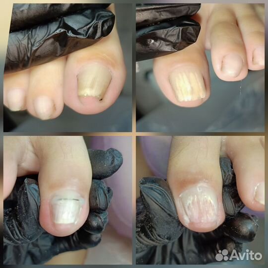 Маникюр педикюр Кондопога