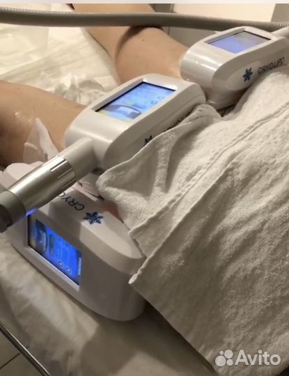 Криолиполиз