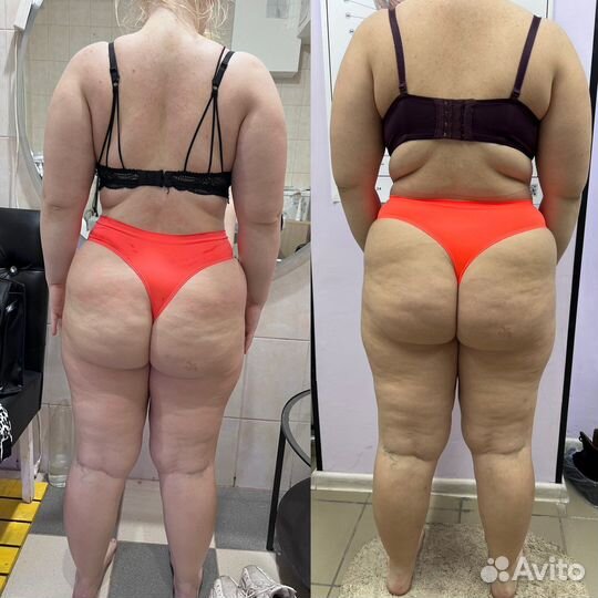 Массаж,солярий,лазерная эпиляция,соляная пещера