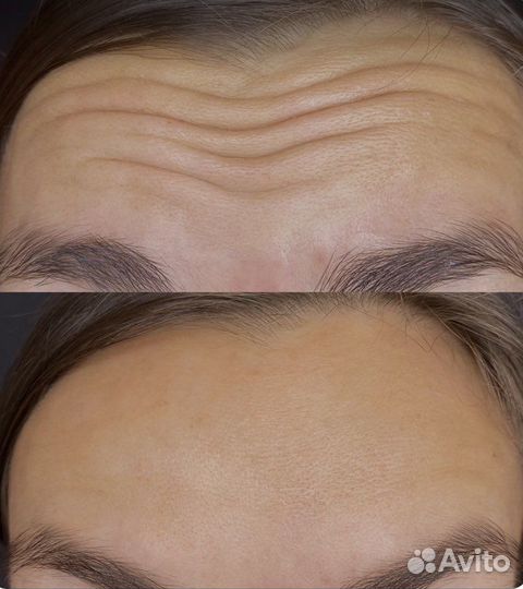 Врач косметолог