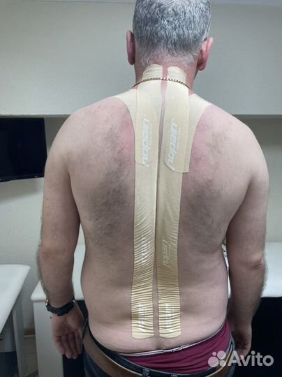 Тейпирование спины, суставов, лица