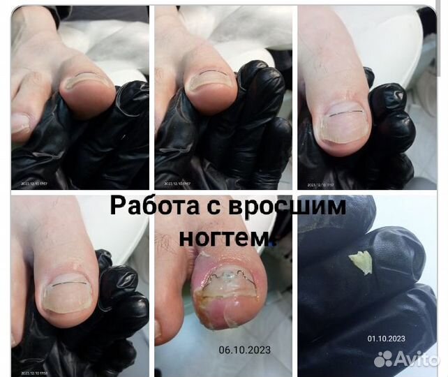 Мастер педикюра, подолог