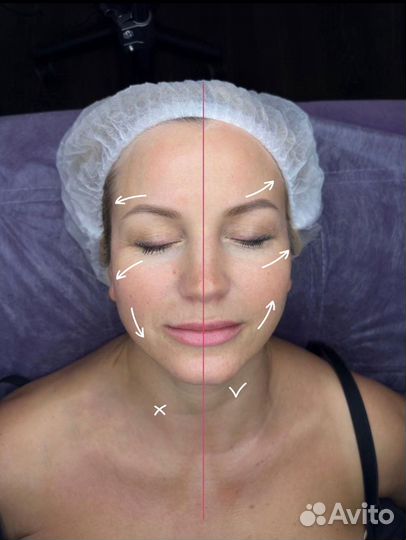 Убрать заломы, убрать морщины, лифтинг