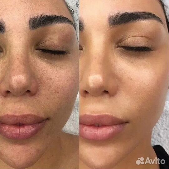 Bb glow тональный крем на год