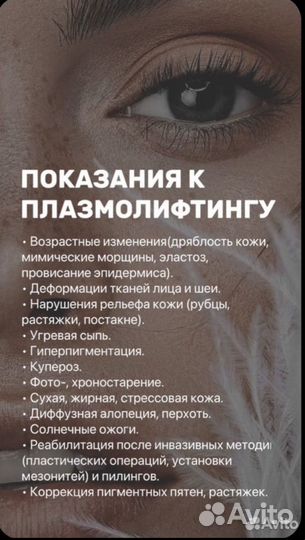 Плазмолифтинг PRP-терапия на аппарате Cortexil