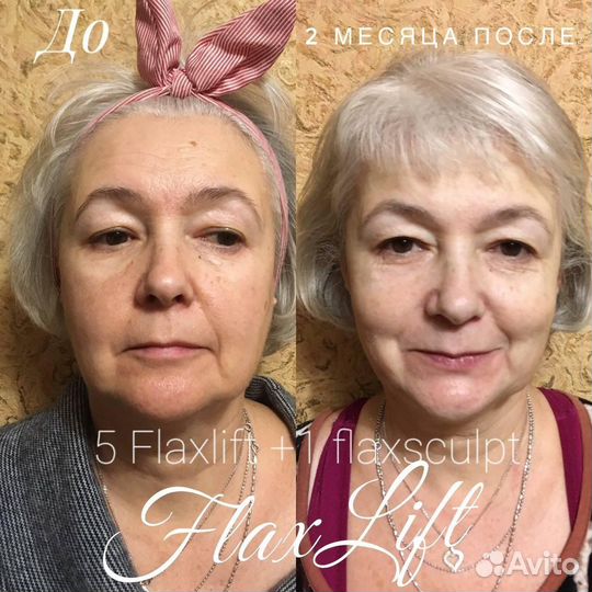 FlaxLift Обучение косметолог. уход. процедуре