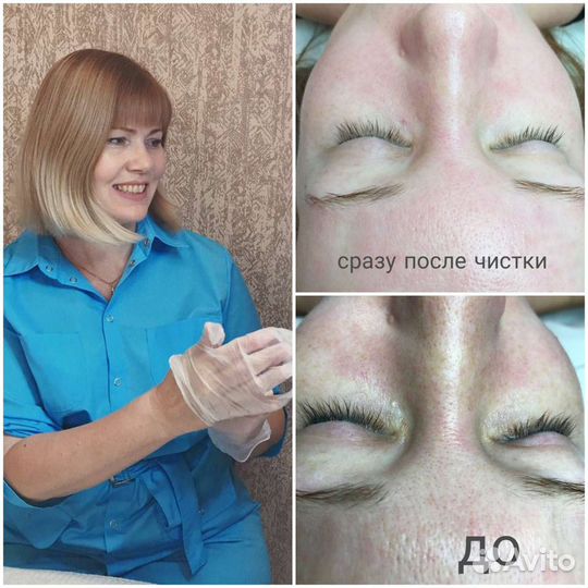 Комбинированная чистка лица