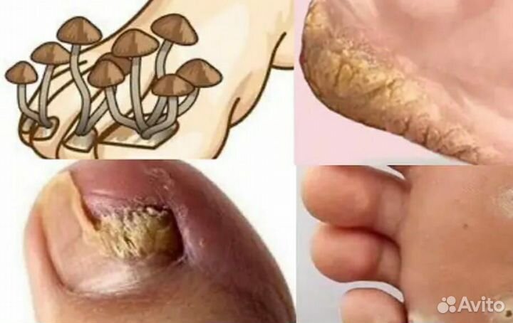 Чистящее средство Баньо эрсаг